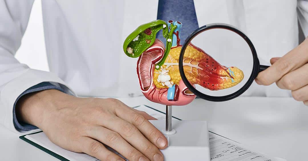 Cancer du pancréas : ces 10 alertes corporelles que l’on néglige trop souvent