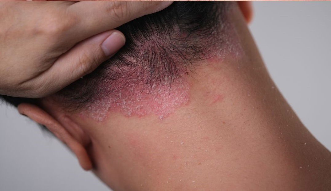 Produits dermatologiques en pharmacie