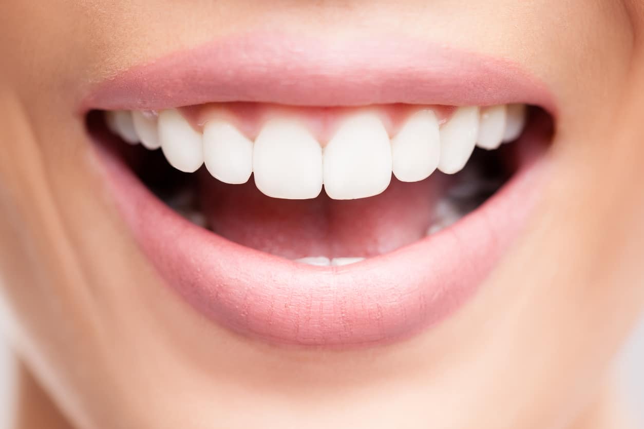 Dents blanches et sourire éclatant