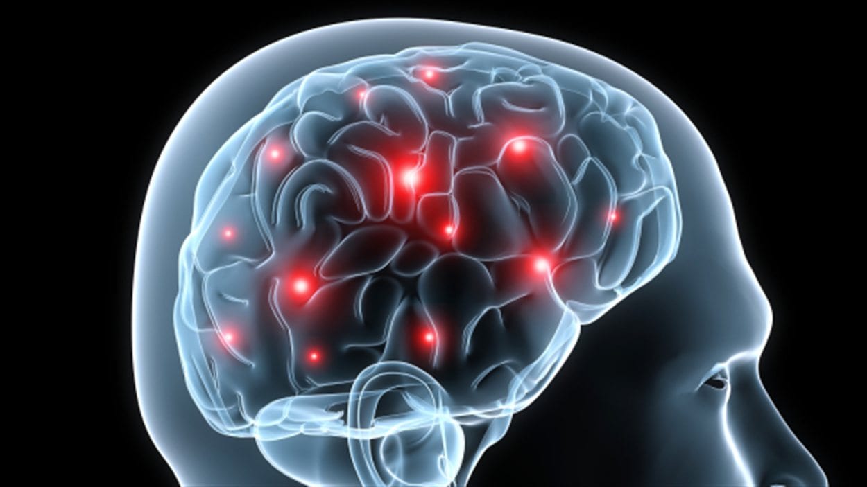 Illustration schématique d'un cerveau humain en activité, avec des zones colorées