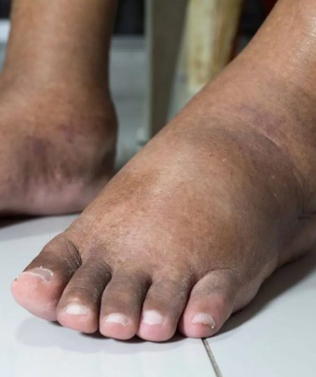 Bain de pieds relaxant avec des pétales de fleurs dans l'eau