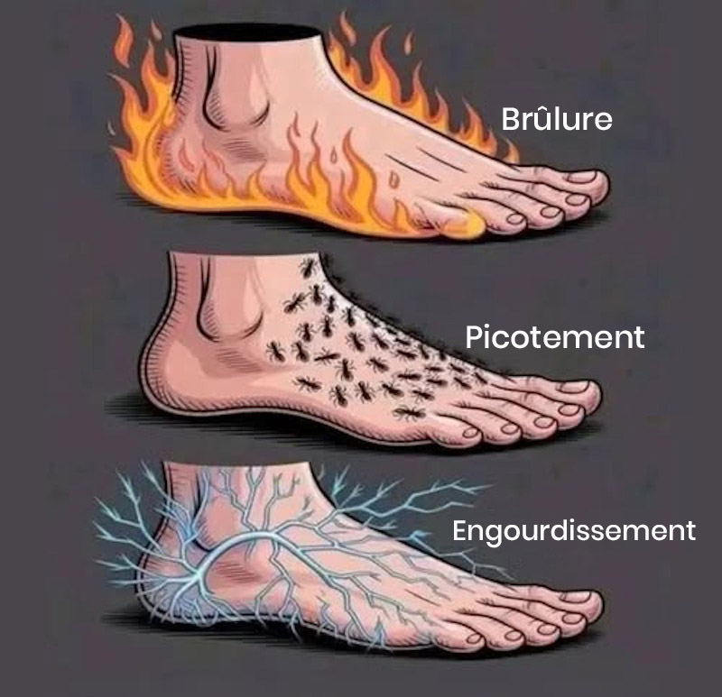 Illustration d'une femme touchant son pied, évoquant une sensation de brûlure