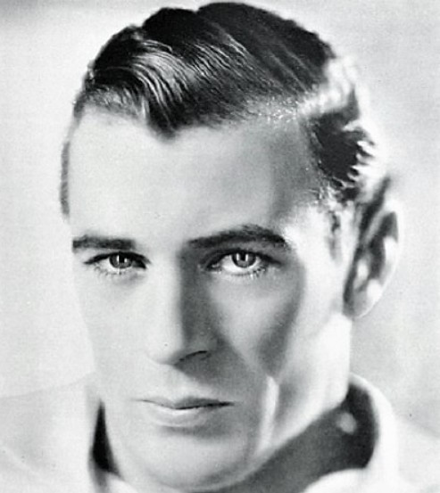 Détail d'une encoche en V à la racine des cheveux sur un front féminin