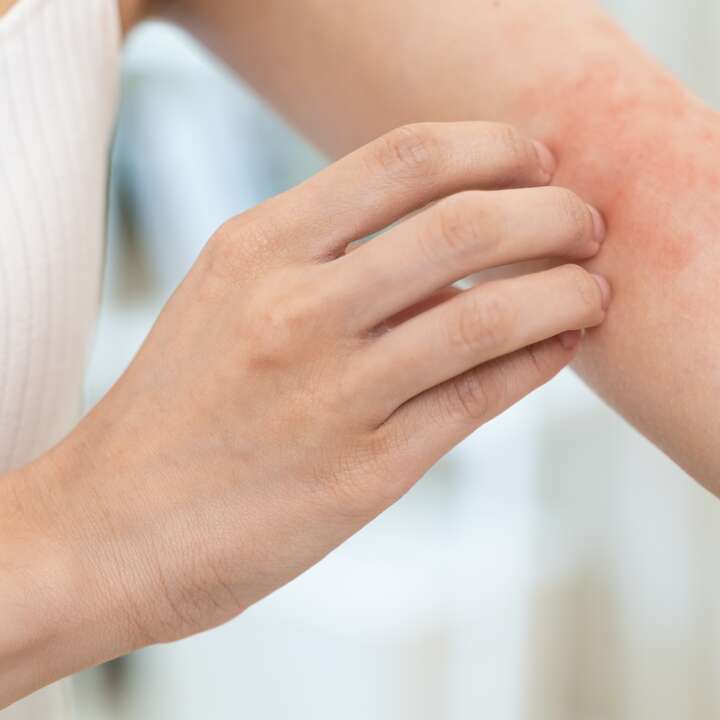 Réaction allergique sur la peau