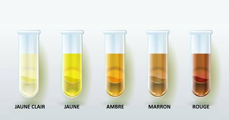 Palette de couleurs urinaires