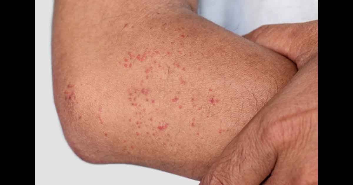 Soins de la peau