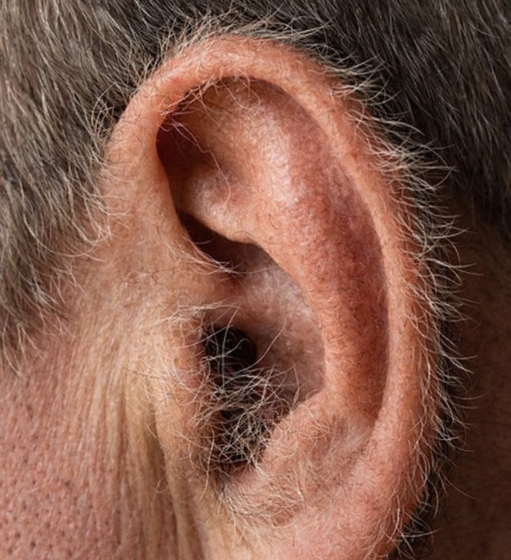 Poils dans les oreilles : ce que ce phénomène naturel dit vraiment de votre corps