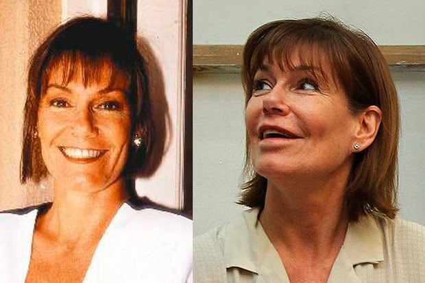 Quand la chirurgie esthétique tourne à l’obsession : ces visages célèbres qui inquiètent