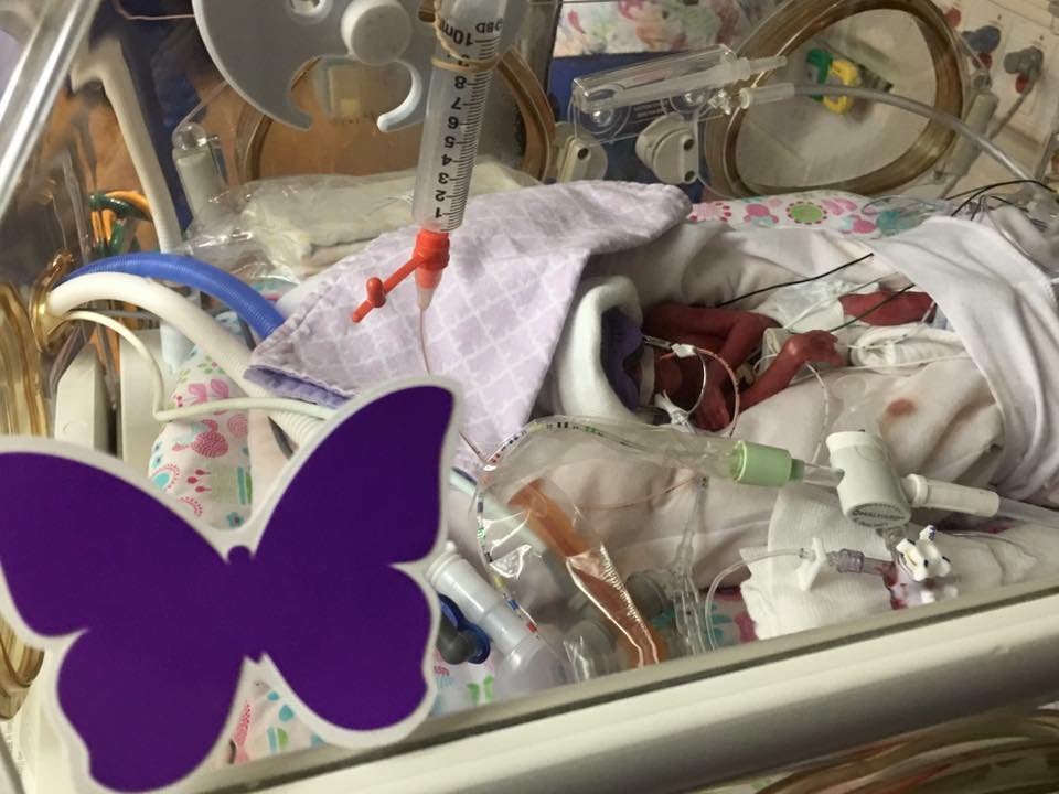 Photo évoquant la délicatesse et la sensibilité en néonatologie