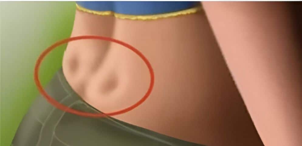 Les fossettes sacrées : que révèlent ces deux creux au bas du dos ?