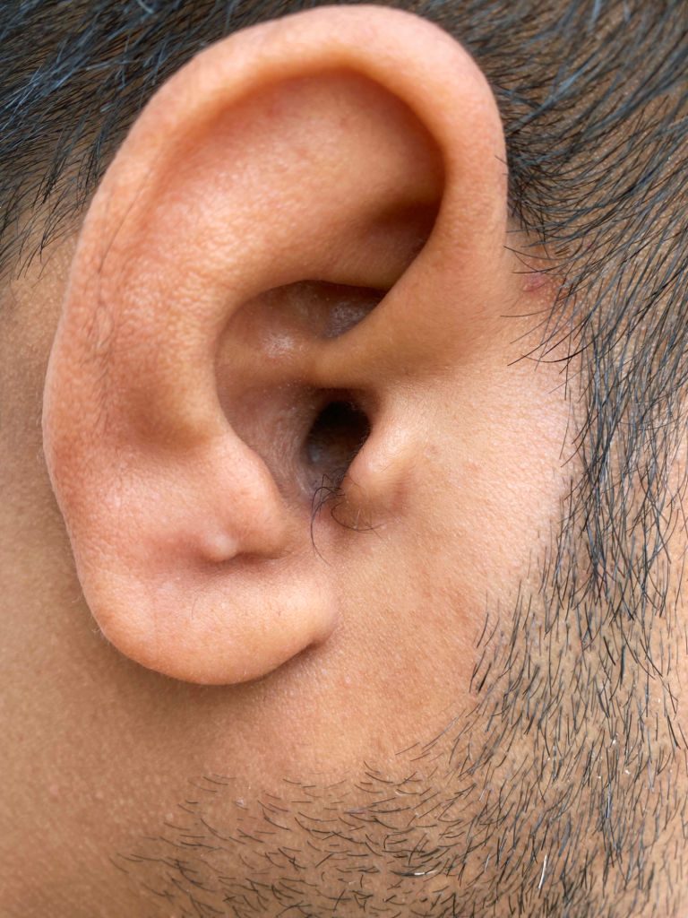 Poils dans les oreilles : ce que ce phénomène naturel dit vraiment de votre corps