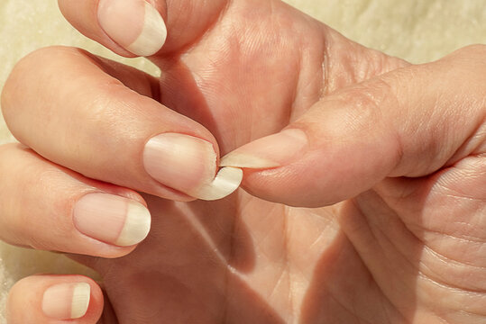 Vos ongles se fendent ou se dédoublent ? Ce que votre santé tente de vous révéler en secret
