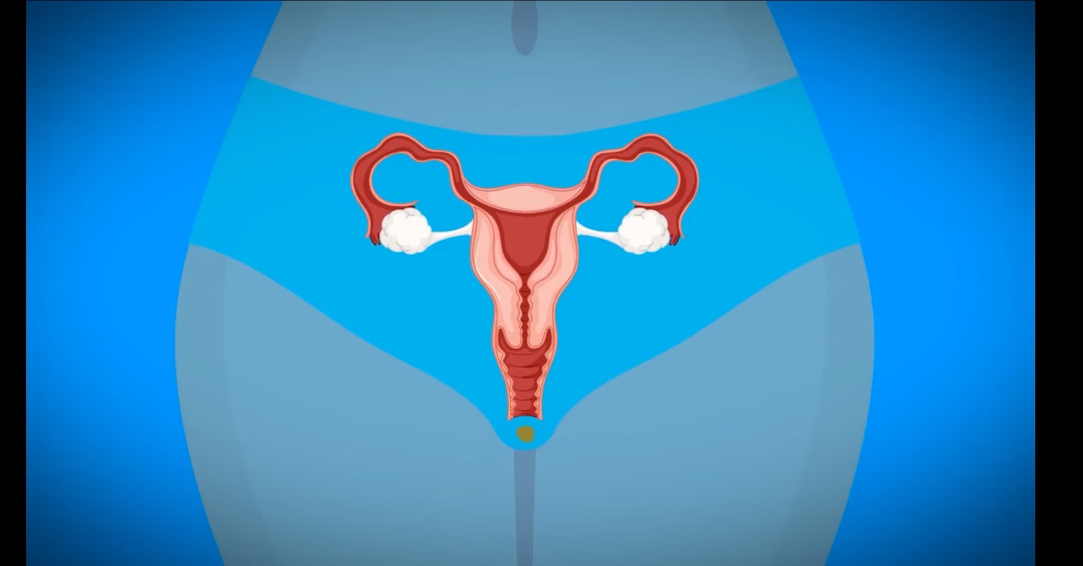 Produits d'hygiène féminine