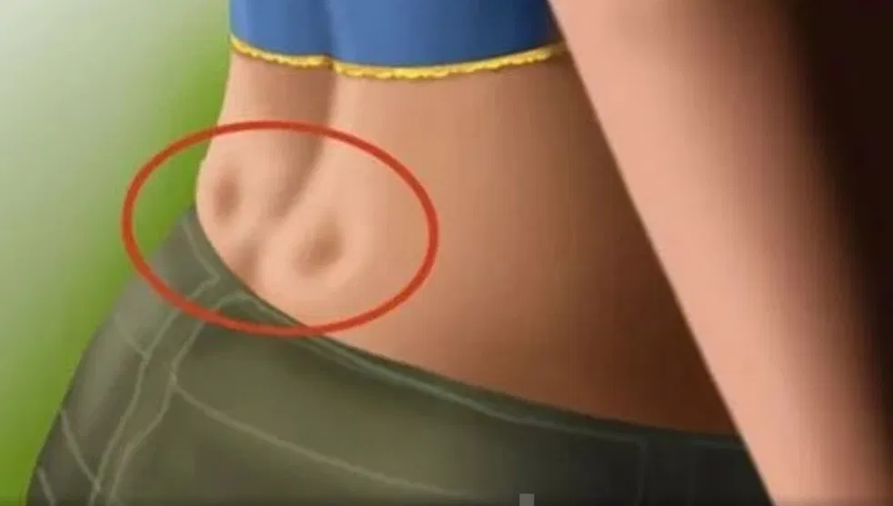 Schéma anatomique montrant la liaison ligamentaire à l'origine des fossettes