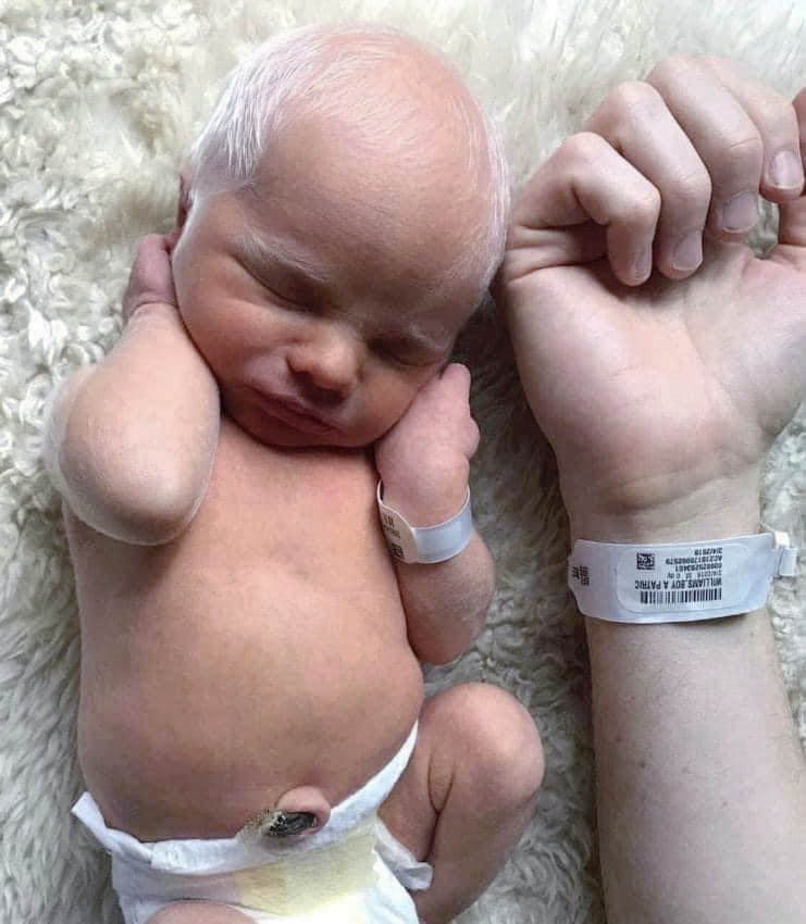 De la neige sur le berceau aux rayons du bonheur : l’incroyable parcours de deux frères albinos devenus des symboles de joie