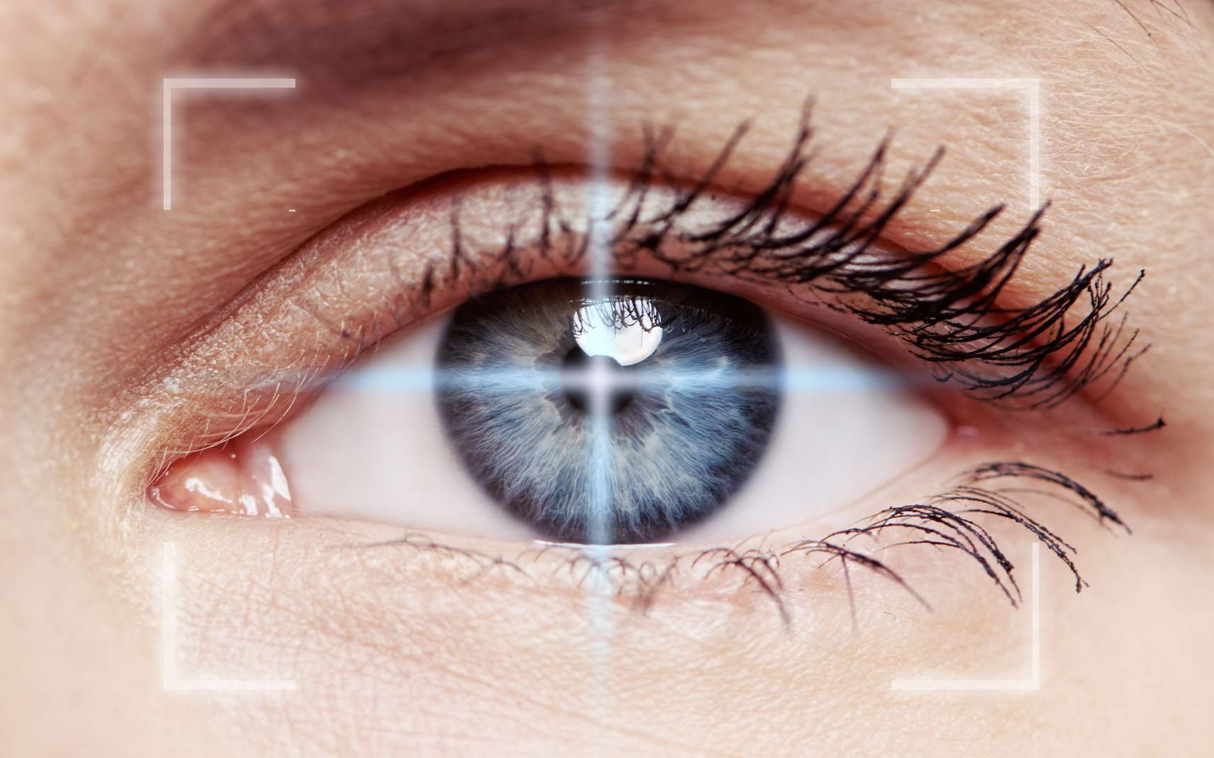 Mouches volantes dans les yeux : quand s'inquiéter et comment réagir ?