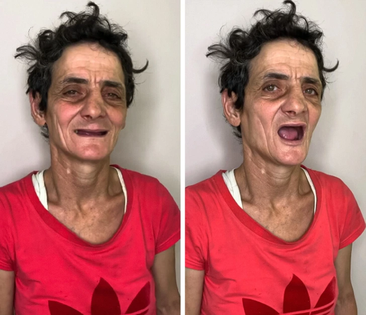 Comparaison avant/après mettant en lumière le changement d'expression et de posture