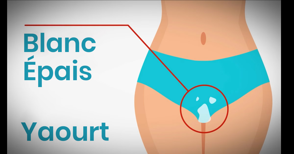 Yaourt blanc épais, symbole d'un déséquilibre