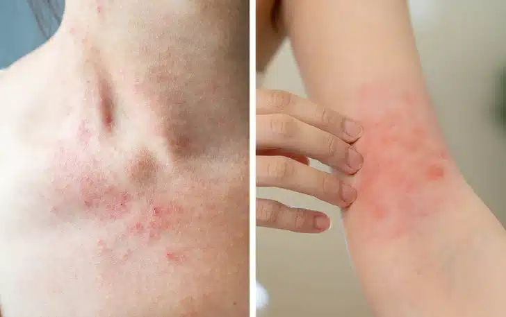 Ces 11 signaux corporels que l’on ignore trop souvent (et qui méritent une vraie attention)