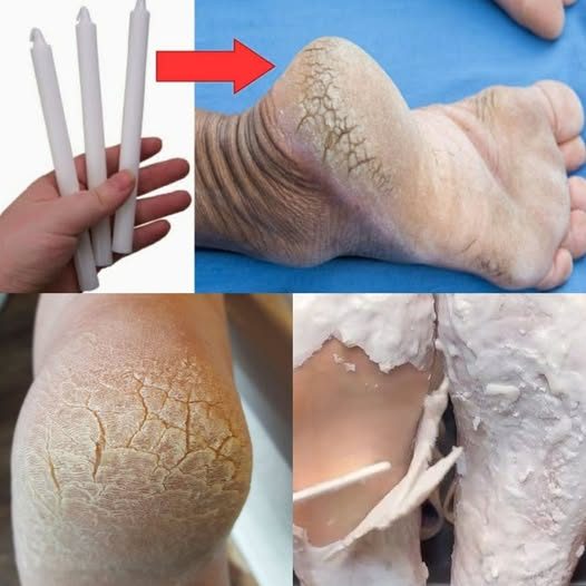 Mains tenant une bougie près de pieds soignés