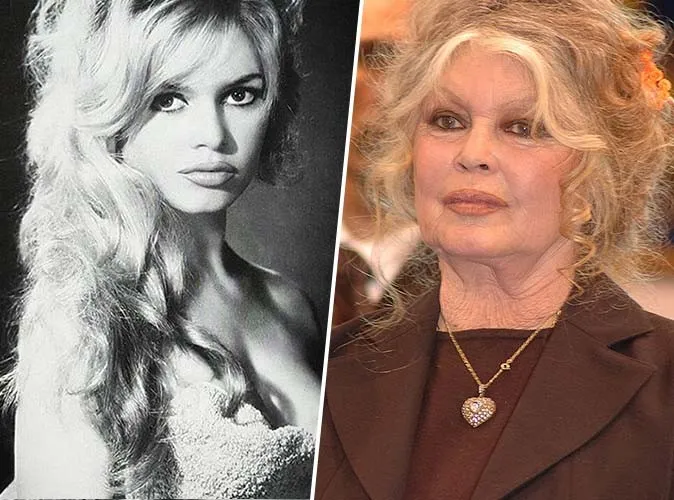 De Brigitte Bardot à Mickey Rourke : ces visages célèbres que le temps a transformés