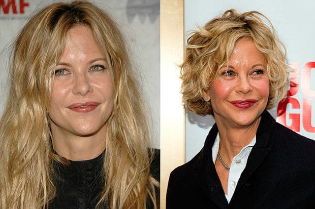 Quand la beauté tourne à l’excès : ces visages célèbres que la chirurgie a transformés