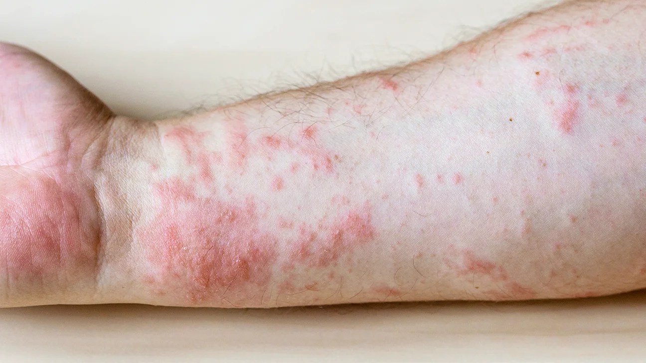 Vos reins tirent la sonnette d’alarme : 9 signaux corporels à ne surtout pas négliger