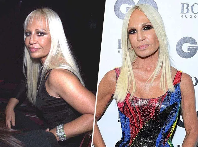Icônes d'hier, visages d'aujourd'hui : quand le temps et les excès redessinent les stars