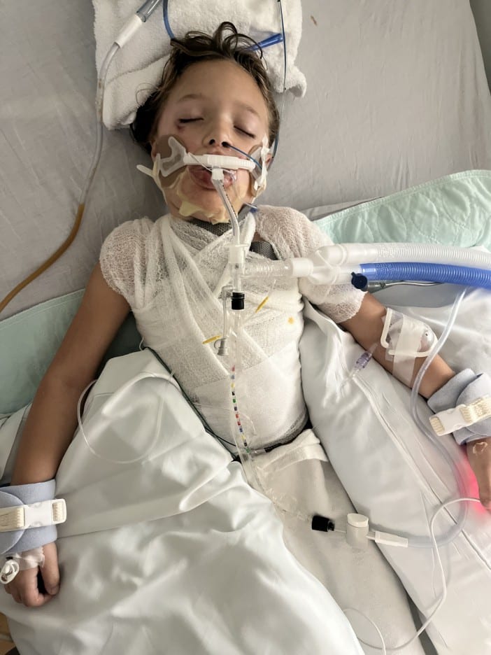 Brûlures au troisième degré et coma artificiel : le geste anodin d’une fillette de 7 ans devant son micro-ondes terrifie les parents