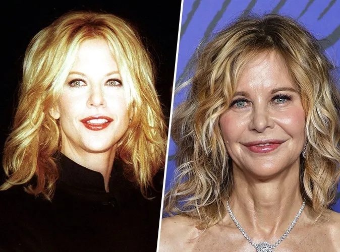 Icônes d'hier, visages d'aujourd'hui : quand le temps et les excès redessinent les stars