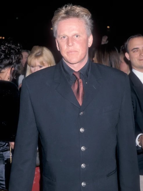 Photo de Gary Busey après son accident