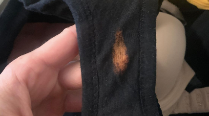 Ces taches blanchâtres dans vos sous-vêtements : un phénomène moins inquiétant qu’il n’y paraît