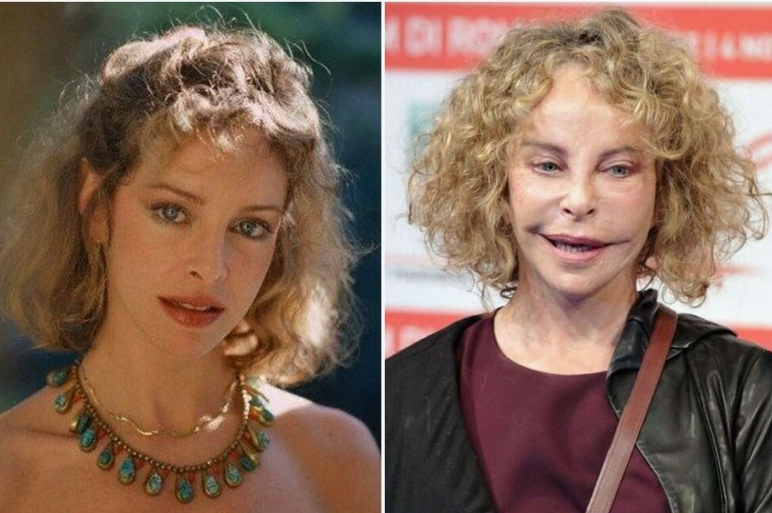 Sydne Rome après son accident, souriante et déterminée