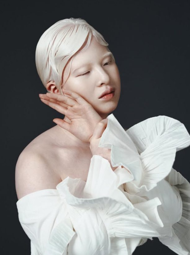 Jeune femme albinos aux cheveux blancs et à la peau claire