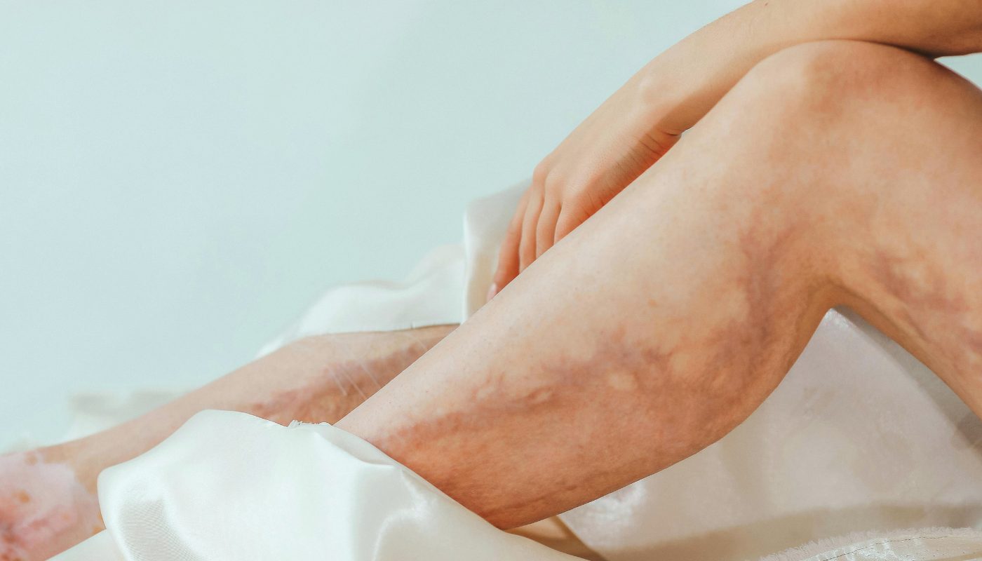 Femme examinant sa jambe