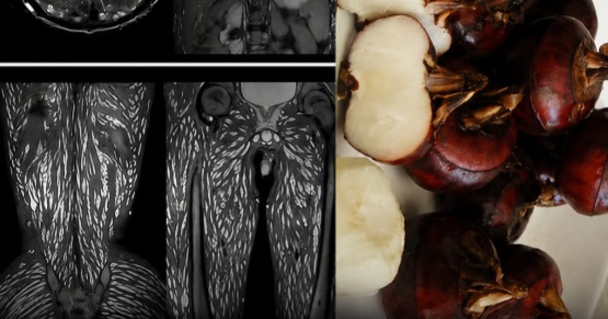 Parasites alimentaires : les aliments à risque et les gestes essentiels pour cuisiner en toute sécurité