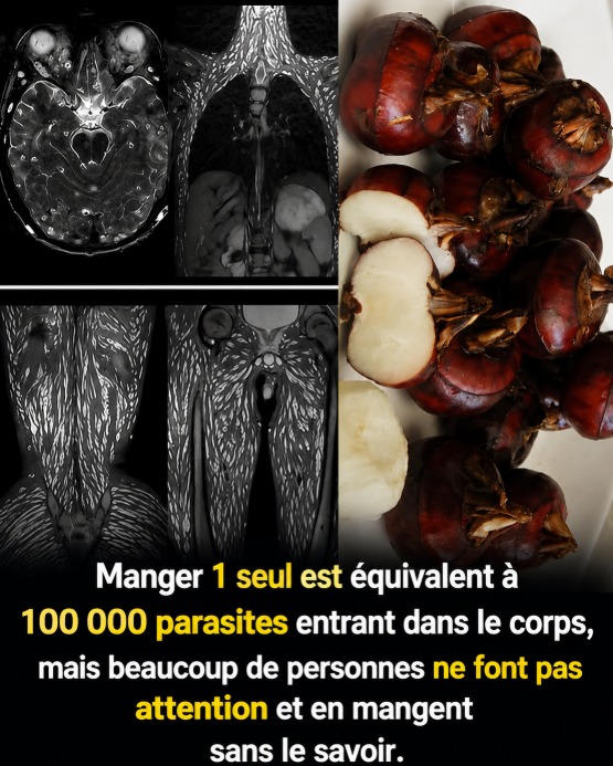 Parasites alimentaires : les aliments à risque et les gestes essentiels pour cuisiner en toute sécurité