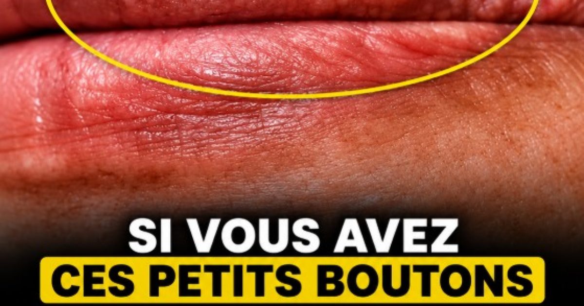 Petits points blancs sur la peau : ce qu'ils révèlent vraiment et comment réagir