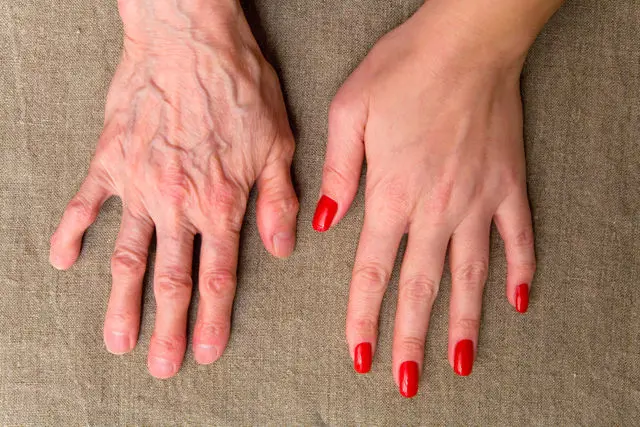 Mains veinées : d'où vient ce phénomène et comment apaiser naturellement vos veines saillantes