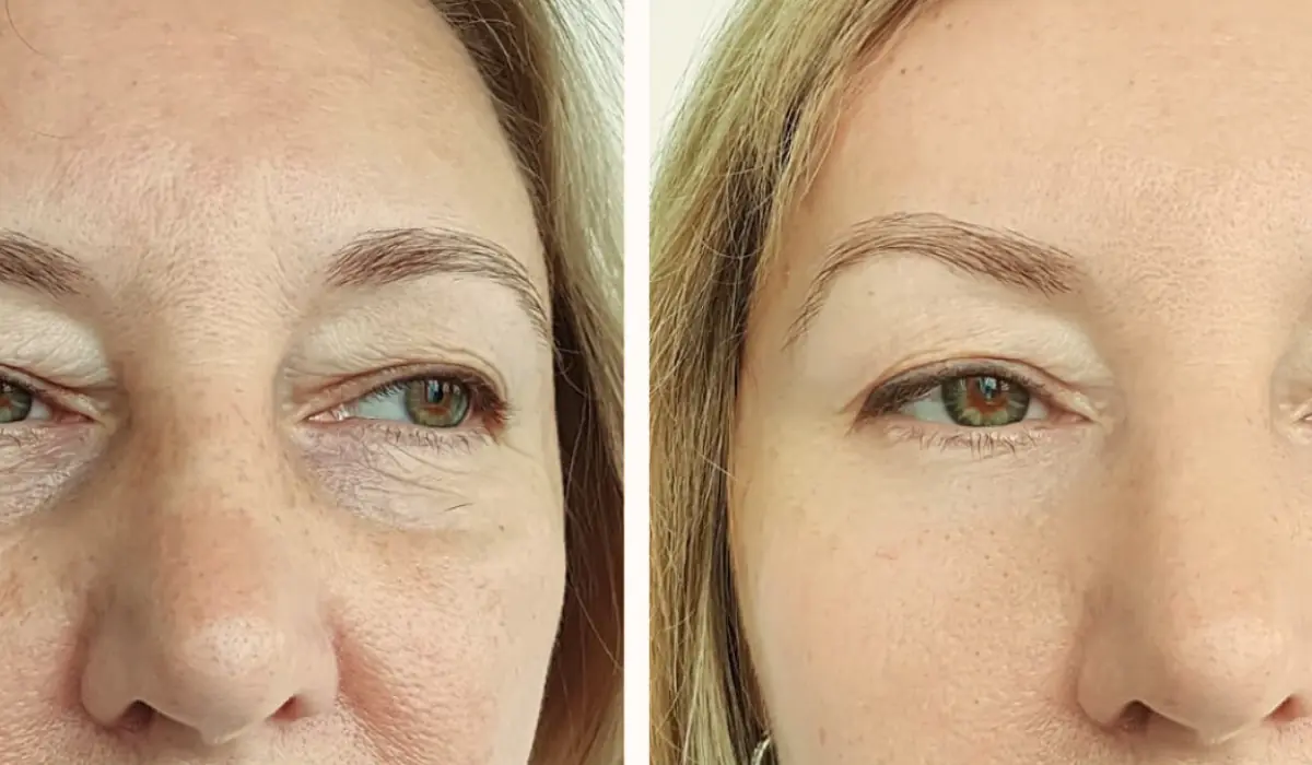 Comparaison avant-après soin naturel pour la peau