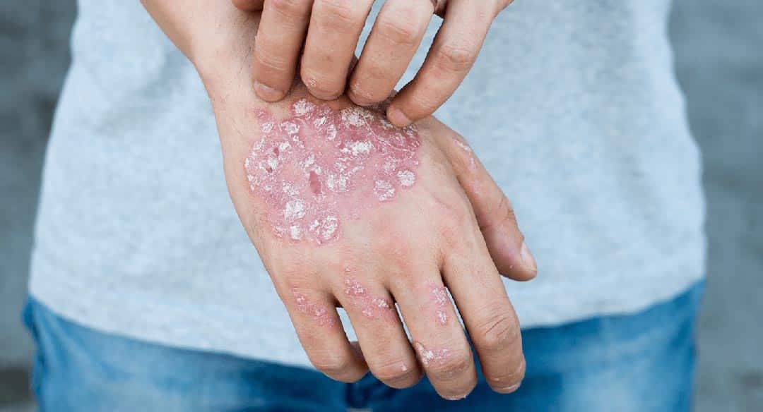 Peau qui parle : ces 7 signes cutanés que vous ne devriez jamais prendre à la légère