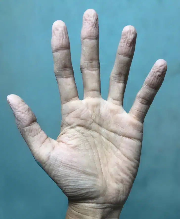Ces 11 signaux corporels que l’on ignore trop souvent (et qui méritent une vraie attention)