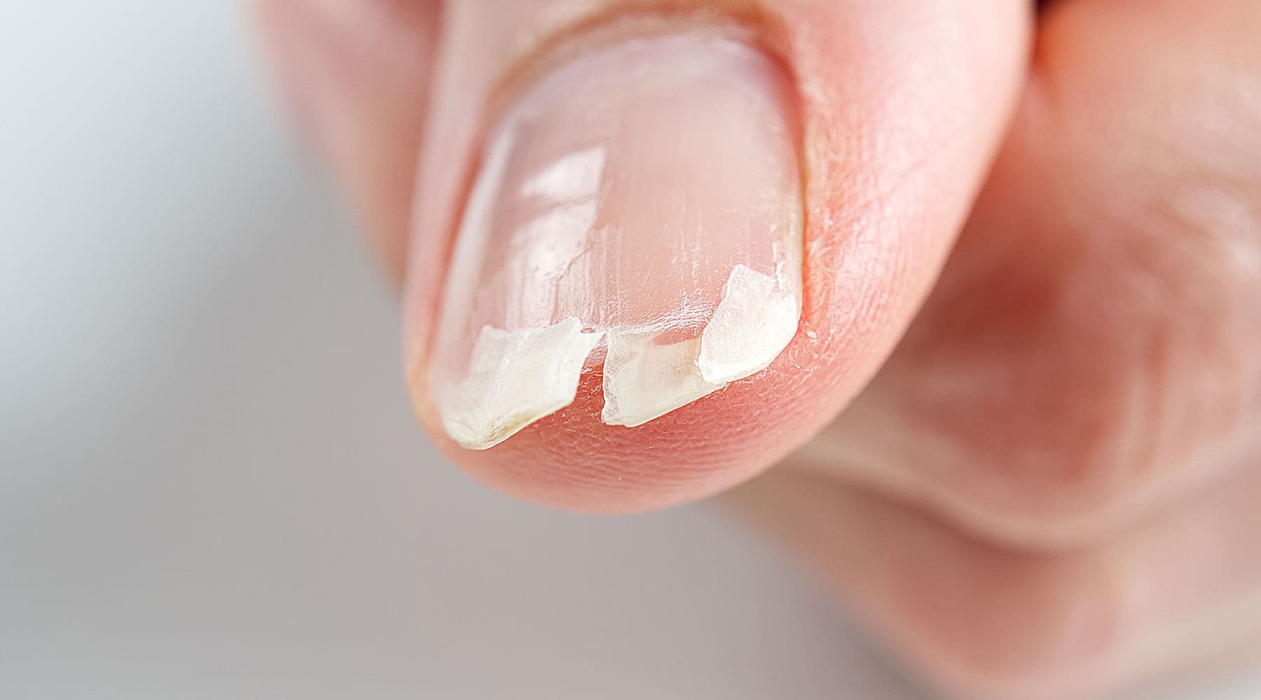 Ongles qui se fendent ou se dédoublent ? Ce que votre santé tente de vous révéler