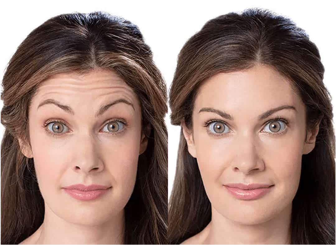 Café et vaseline : le duo surprenant pour une peau repulpée et lumineuse