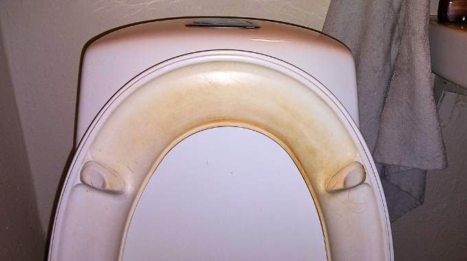 Gros plan sur des traces jaunes persistantes sur un abattant de toilettes en plastique