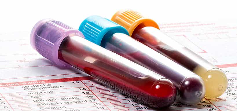 Un échantillon de sang dans un tube, évoquant un test génétique ou une analyse ADN