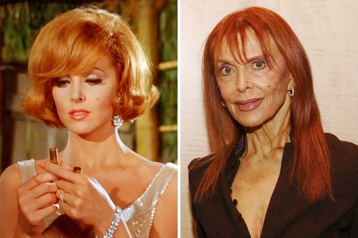De Brigitte Bardot à Mickey Rourke : ces visages célèbres que le temps a transformés