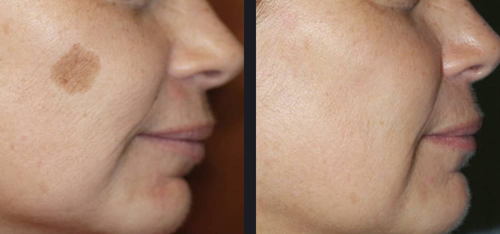 Le secret de grand-mère anti-âge : une crème visage maison au bicarbonate de soude pour un teint unifié