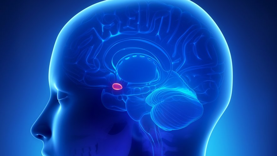 Illustration de l'énigme du tronc suspendu montrant les quatre personnages