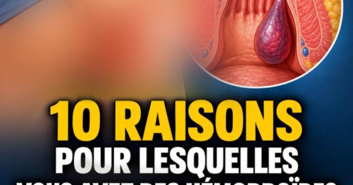 Hémorroïdes : causes, traitements et astuces pour enfin s'en débarrasser